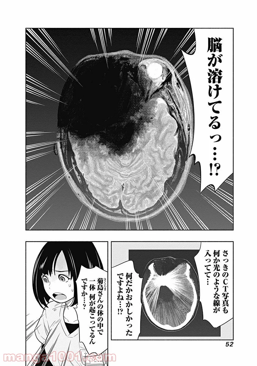 ラジエーションハウス 漫画 第1話 - Page 50