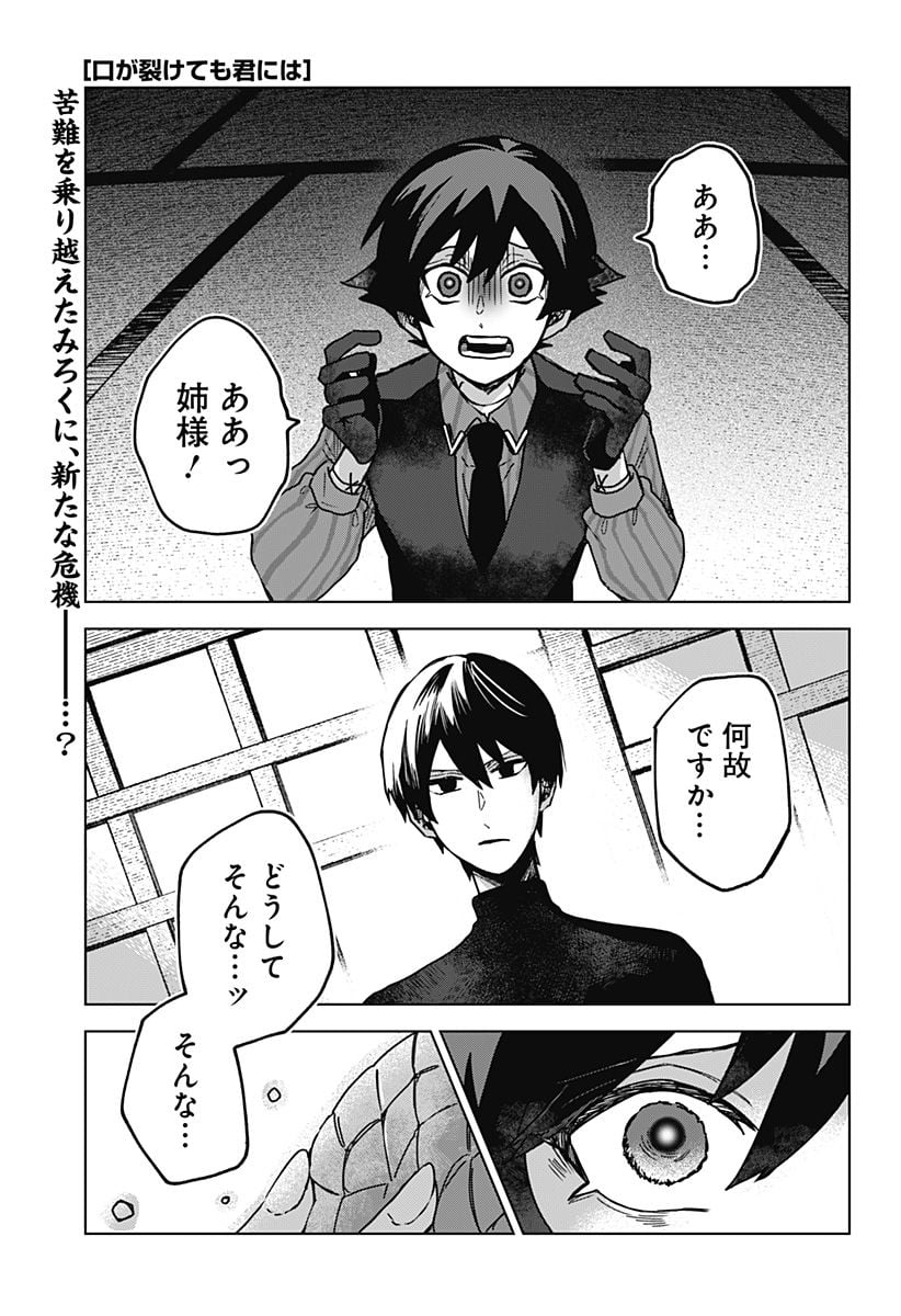 口が裂けても君には 第71話 - Page 1