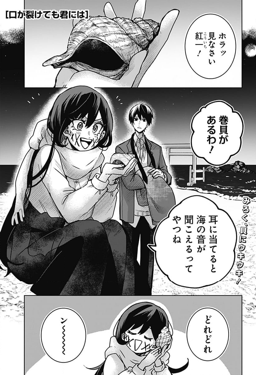 口が裂けても君には 第79話 - Page 1